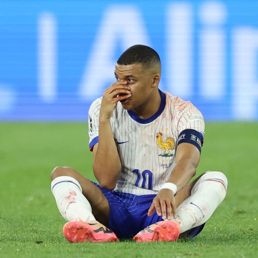 Euro 2024 : La FFF donne des nouvelles de Mbappé après sa blessure face à l'Autriche